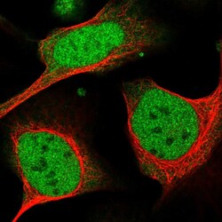 Invitrogen DDX1 Polyclonal Antibody 100 &mu;L; Unconjugated:Antibodies,