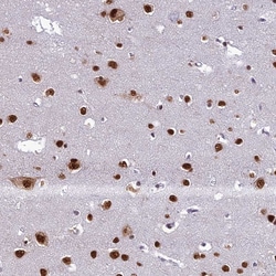Invitrogen DDX1 Polyclonal Antibody 100 &mu;L; Unconjugated:Antibodies,