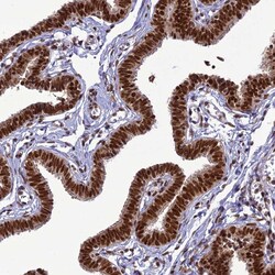 Invitrogen DDX1 Polyclonal Antibody 100 &mu;L; Unconjugated:Antibodies,