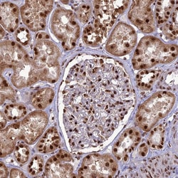 Invitrogen DDX1 Polyclonal Antibody 100 &mu;L; Unconjugated:Antibodies,