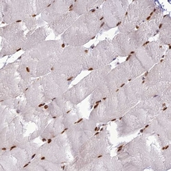 Invitrogen DDX1 Polyclonal Antibody 100 &mu;L; Unconjugated:Antibodies,