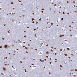 Invitrogen DDX1 Polyclonal Antibody 100 &mu;L; Unconjugated:Antibodies,