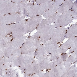 Invitrogen DDX1 Polyclonal Antibody 100 &mu;L; Unconjugated:Antibodies,