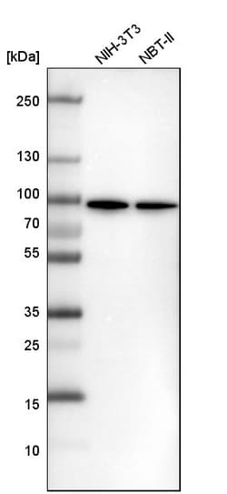Invitrogen DDX1 Polyclonal Antibody 100 &mu;L; Unconjugated:Antibodies,