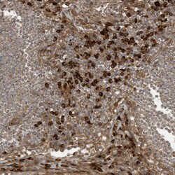 Invitrogen DDIT4 Polyclonal Antibody 100 &mu;L; Unconjugated:Antibodies,