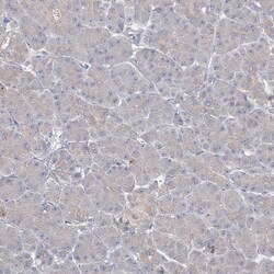 Invitrogen PRC1 Polyclonal Antibody 100 &mu;L | Buy Online | Invitrogen&trade; | Fisher Scientific