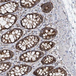 Invitrogen PNPase Polyclonal Antibody 100 &mu;L; Unconjugated:Antibodies,