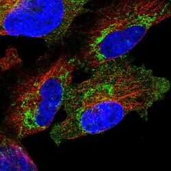 Invitrogen PNPase Polyclonal Antibody 100 &mu;L; Unconjugated:Antibodies,