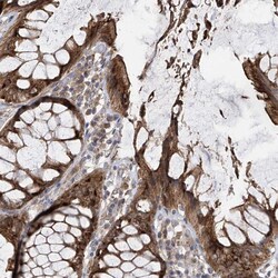 Invitrogen PNPase Polyclonal Antibody 100 &mu;L; Unconjugated:Antibodies,