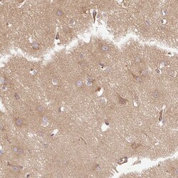 Invitrogen Dynactin 1 Polyclonal Antibody 100 &mu;L; Unconjugated:Antibodies,
