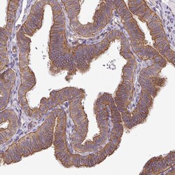Invitrogen Dynactin 1 Polyclonal Antibody 100 &mu;L; Unconjugated:Antibodies,