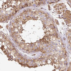 Invitrogen Dynactin 1 Polyclonal Antibody 100 &mu;L; Unconjugated:Antibodies,