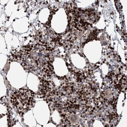 Invitrogen KIF4A Polyclonal Antibody 100 &mu;L; Unconjugated:Antibodies,