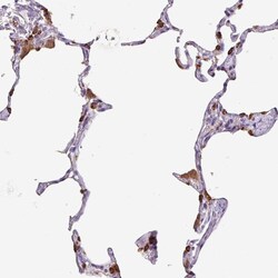 Invitrogen SFTPB Polyclonal Antibody 100 &mu;L | Buy Online | Invitrogen&trade; | Fisher Scientific