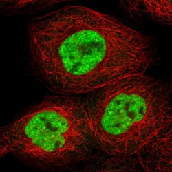 Invitrogen RBM10 Polyclonal Antibody 100 &mu;L; Unconjugated:Antibodies,