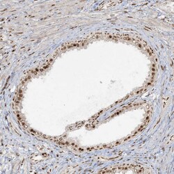 Invitrogen RBM10 Polyclonal Antibody 100 &mu;L; Unconjugated:Antibodies,