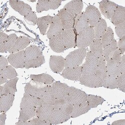 Invitrogen RBM10 Polyclonal Antibody 100 &mu;L; Unconjugated:Antibodies,