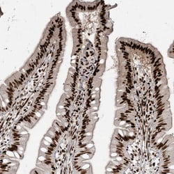 Invitrogen RBM10 Polyclonal Antibody 100 &mu;L; Unconjugated:Antibodies,