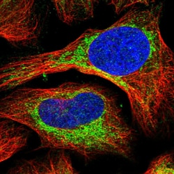Invitrogen ABCB7 Polyclonal Antibody 100 &mu;L; Unconjugated:Antikroppar