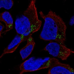 Invitrogen HFM1 Polyclonal Antibody 100 &mu;L; Unconjugated:Antibodies,