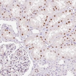Invitrogen HNF1A Polyclonal Antibody 100 &mu;L; Unconjugated:Antibodies,