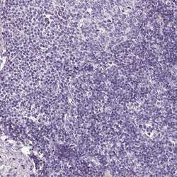 Invitrogen HNF1A Polyclonal Antibody 100 &mu;L; Unconjugated:Antibodies,