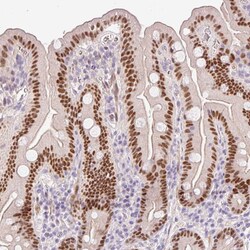 Invitrogen HNF1A Polyclonal Antibody 100 &mu;L; Unconjugated:Antibodies,