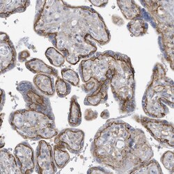 Invitrogen ASCT2 Polyclonal Antibody 100 &mu;L; Unconjugated:Antibodies,