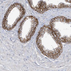 Invitrogen ASCT2 Polyclonal Antibody 100 &mu;L; Unconjugated:Antibodies,