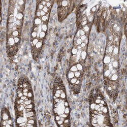 Invitrogen ASCT2 Polyclonal Antibody 100 &mu;L; Unconjugated:Antibodies,