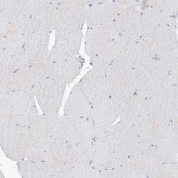 Invitrogen ASCT2 Polyclonal Antibody 100 &mu;L; Unconjugated:Antibodies,