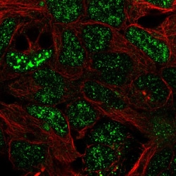 Invitrogen SFMBT2 Polyclonal Antibody 100 &mu;L; Unconjugated:Antibodies,