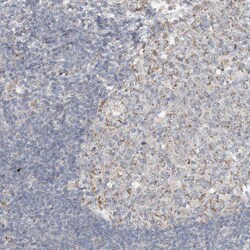 Invitrogen SFMBT2 Polyclonal Antibody 100 &mu;L; Unconjugated:Antibodies,