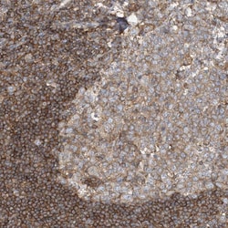 Invitrogen SFMBT2 Polyclonal Antibody 100 &mu;L; Unconjugated:Antibodies,