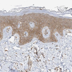 Invitrogen STAM2 Polyclonal Antibody 100 &mu;L; Unconjugated:Antibodies,