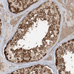 Invitrogen STAM2 Polyclonal Antibody 100 &mu;L; Unconjugated:Antibodies,