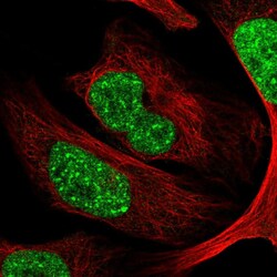 Invitrogen CDYL Polyclonal Antibody 100 &mu;L; Unconjugated:Antibodies,