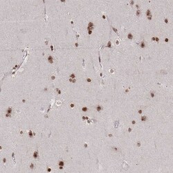 Invitrogen CDYL Polyclonal Antibody 100 &mu;L; Unconjugated:Antibodies,