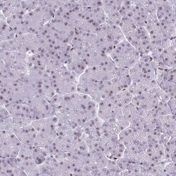 Invitrogen CDYL Polyclonal Antibody 100 &mu;L; Unconjugated:Antibodies,