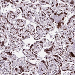 Invitrogen CDYL Polyclonal Antibody 100 &mu;L; Unconjugated:Antibodies,