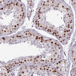 Invitrogen CDYL Polyclonal Antibody 100 &mu;L; Unconjugated:Antibodies,