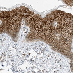 Invitrogen EDF1 Polyclonal Antibody 100 &mu;L; Unconjugated:Antibodies,