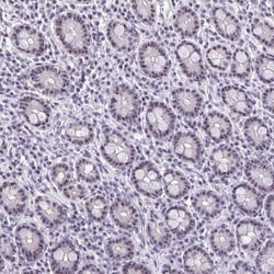 Invitrogen NIFK Polyclonal Antibody 100 &mu;L; Unconjugated:Antibodies,