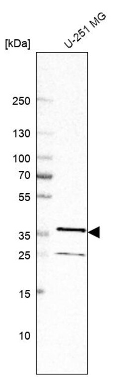 Invitrogen NIFK Polyclonal Antibody 100 &mu;L | Buy Online | Invitrogen&trade; | Fisher Scientific
