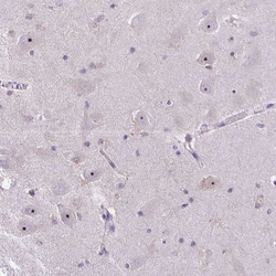 Invitrogen NIFK Polyclonal Antibody 100 &mu;L; Unconjugated:Antibodies,