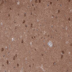 Invitrogen GTPBP9 Polyclonal Antibody 100 &mu;L | Buy Online | Invitrogen&trade; | Fisher Scientific