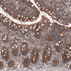 Invitrogen GTPBP9 Polyclonal Antibody 100 &mu;L | Buy Online | Invitrogen&trade; | Fisher Scientific