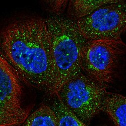 Invitrogen CGI58 Polyclonal Antibody 100 &mu;L; Unconjugated:Antibodies,