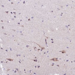 Invitrogen CGI58 Polyclonal Antibody 100 &mu;L; Unconjugated:Antibodies,