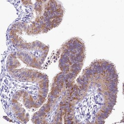 Invitrogen CGI58 Polyclonal Antibody 100 &mu;L; Unconjugated:Antibodies,